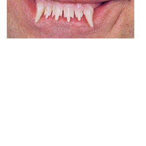 glowing werewolf teeth